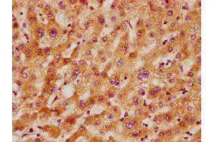 IHC image of ABIN7142970 diluted at 1:300 and staining in paraffin-embedded human liver tissue performed on a Leica BondTM system.