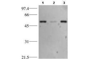 Western blotting using anti-p53. (p53 抗体)