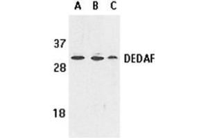 Western blot analysis of DEDAF expression in human A549 (lane A), HepG2 (lane B), and mouse 3T3 (lane C) cell lysates with AP30284PU-N DEDAF antibody at 1 μg /ml. (RYBP 抗体)