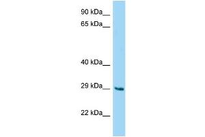 WB Suggested Anti-Fam122b Antibody Titration: 1. (FAM122B 抗体  (N-Term))