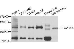 Western blot analysis of extracts of various cells, using PLA2G4A antibody. (PLA2G4A 抗体)