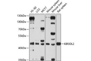 Western blot analysis of extracts of various cell lines, using KIR3DL2 antibody (ABIN6131968, ABIN6142888, ABIN6142889 and ABIN6214251) at 1:1000 dilution. (KIR3DL2 抗体  (AA 361-455))