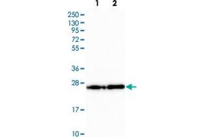 Western blot analysis of Lane 1: Human cell line RT-4 Lane 2: Human cell line U-251MG with PDAP1 polyclonal antibody  at 1:250-1:500 dilution. (PDAP1 抗体)