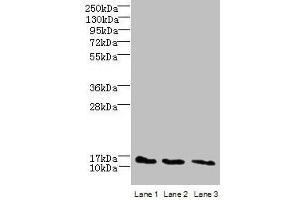 Western blot All lanes: C2orf15 antibody at 6 μg/mL Lane 1: U251 whole cell lysate Lane 2: MCF-7 whole cell lysate Lane 3: HCT116 whole cell lysate Secondary Goat polyclonal to rabbit IgG at 1/10000 dilution Predicted band size: 14 kDa Observed band size: 14 kDa (C2ORF15 抗体  (AA 1-125))