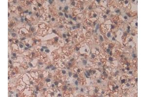 Immunohistochemistry (IHC) image for anti-Glucosidase, Alpha, Acid (GAA) (AA 595-770) antibody (ABIN7431263)