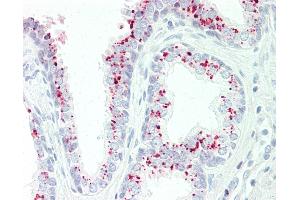 Anti-GAA antibody IHC staining of human prostate. (GAA 抗体  (AA 174-203))