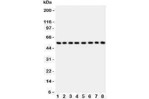 Western blot testing of P2X2 antibody and Lane 1:  rat brain;  2: mouse brain;  3: human placenta;  4: (h) HeLa;  5: (h) SHG-44;  6: (m) Neuro-2a;  7: (h) 22RV1;  8: (h) U87 lysate. (P2RX2 抗体  (AA 139-471))