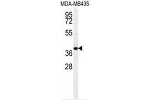 CCR8 Antibody (C-term) western blot analysis in MDA-MB435 cell line lysates (35µg/lane). (CCR8 抗体  (C-Term))