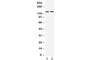 Western blot testing of human 1) SMMC and 2) 293 cell lysate with TRPM5 antibody.