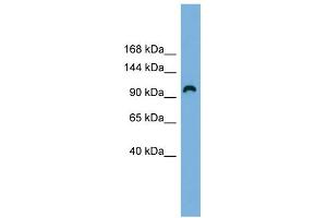 WB Suggested Anti-RAPGEF3 Antibody Titration: 0. (RAPGEF3 抗体  (Middle Region))