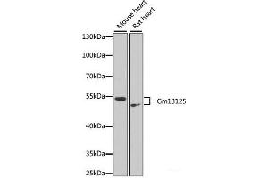 Western blot analysis of extracts of various cell lines using Gm13125 Polyclonal Antibody at dilution of 1:1000. (Pramel15 抗体)