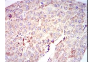 Image no. 2 for anti-V-Raf-1 Murine Leukemia Viral Oncogene Homolog 1 (RAF1) antibody (ABIN1500583) (RAF1 抗体)