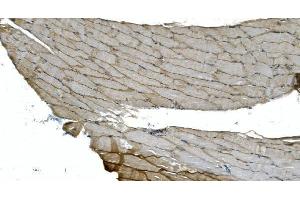 IHC analysis of H Cadherin/CDH13 using anti-H Cadherin/CDH13 antibody (ABIN7600095). (Cadherin 13 抗体  (AA 149-692))