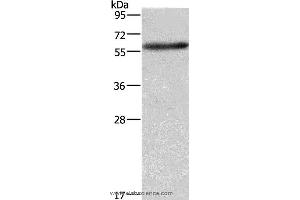 Western blot analysis of A172 cell, using AMIGO2 Polyclonal Antibody at dilution of 1:597 (AMIGO2 抗体)