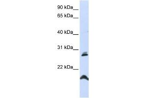 SPATA9 antibody used at 1 ug/ml to detect target protein. (SPATA9 抗体  (N-Term))