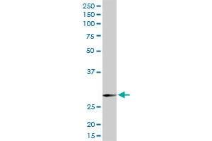 SNAP29 MaxPab rabbit polyclonal antibody. (SNAP29 抗体  (AA 1-258))