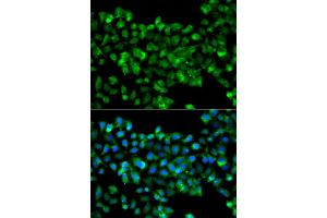 Immunofluorescence analysis of A549 cells using CBR3 antibody (ABIN5975603). (CBR3 抗体)