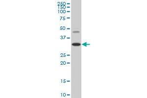 HOXD8 monoclonal antibody (M02), clone 3G8 Western Blot analysis of HOXD8 expression in HepG2 . (HOXD8 抗体  (AA 126-190))