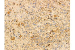 ABIN6256878 and ABIN6274572 at 1/100 staining Mouse brain tissue by IHC-P. (Serotonin Receptor 2B 抗体  (Internal Region))