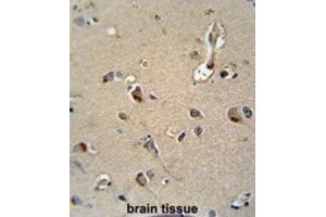 Immunohistochemistry (IHC) image for anti-Myelin Protein Zero (MPZ) antibody (ABIN3003838) (MPZ 抗体)