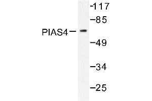 Image no. 2 for anti-Protein Inhibitor of Activated STAT, 4 (PIAS4) antibody (ABIN271954)