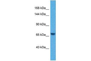 Host:  Rabbit  Target Name:  KL  Sample Tissue:  Human Jurkat Whole Cell  Antibody Dilution:  1ug/ml (Klotho 抗体  (N-Term))