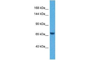Host:  Rabbit  Target Name:  KL  Sample Tissue:  Human Jurkat Whole Cell  Antibody Dilution:  1ug/ml (Klotho 抗体  (N-Term))