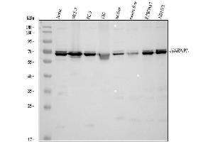 Western blot analysis of HNRNPL using anti-HNRNPL antibody (ABIN4886624).