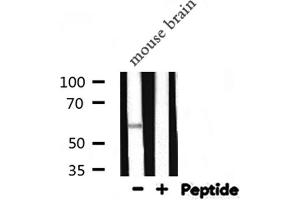 Western blot analysis of ALPL expression in Mouse brain lysate (ALPL 抗体  (Internal Region))