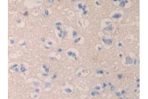 Used in DAB staining on fromalin fixed paraffin- embedded liver tissue (QSOX1 抗体  (AA 37-181))