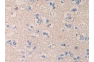 Used in DAB staining on fromalin fixed paraffin- embedded liver tissue (QSOX1 抗体  (AA 37-181))