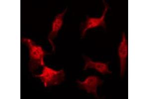 ABIN6269087 staining HeLa by IF/ICC. (HSP27 抗体  (Internal Region))