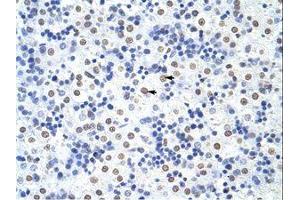 Image no. 1 for anti-Heterogeneous Nuclear Ribonucleoprotein U-Like 1 (HNRNPUL1) (C-Term) antibody (ABIN203251) (HNRNPUL1 抗体  (C-Term))