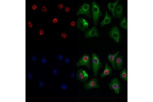 ABIN7093889 and ABIN7097932 staining Hela cells by IF/ICC. (GSTO2 抗体  (N-Term))