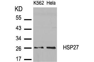 Image no. 2 for anti-Heat Shock 27kDa Protein 1 (HSPB1) (AA 80-84) antibody (ABIN197491) (HSP27 抗体  (AA 80-84))
