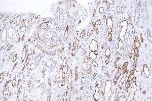 Immunohistochemical staining (Formalin-fixed paraffin-embedded sections) of human kidney tissue using C4A monoclonal antibody, clone C4D204 . (C4A 抗体)