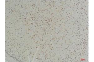 Immunohistochemistry (IHC) analysis of paraffin-embedded Mouse Brain Tissue using Connexin-26Rabbit Polyclonal Antibody diluted at 1:200. (GJB2 抗体)