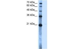 OLR1 antibody used at 2. (OLR1 抗体)
