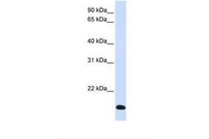 Image no. 1 for anti-Ring Finger Protein 185 (RNF185) (AA 74-123) antibody (ABIN6738076) (RNF185 抗体  (AA 74-123))