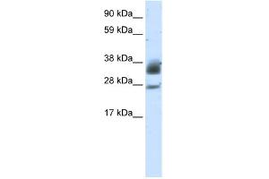 WB Suggested Anti-SIRT5 Antibody Titration:  5.