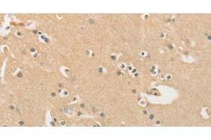 Immunohistochemistry of paraffin-embedded Human brain using CHRNA2 Polyclonal Antibody at dilution of 1:40 (CHRNA2 抗体)