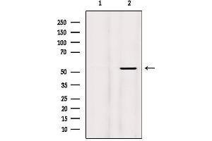 Western blot analysis of extracts from Mouse brain, using Phospho-MEF2A (Thr319) Antibody.