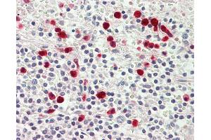 Anti-MYO1E / Myosin IE antibody IHC staining of human spleen. (MYO1E 抗体  (AA 228-257))