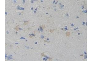 Detection of WARS in Human Cerebrum Tissue using Polyclonal Antibody to Tryptophanyl tRNA Synthetase (WARS) (WARS 抗体  (AA 247-458))