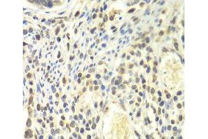 Immunohistochemistry of paraffin-embedded Human colon using PSMA4 Polyclonal Antibody at dilution of 1:100 (40x lens). (PSMA4 抗体)