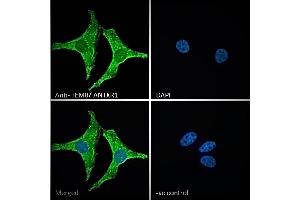 ABIN185280 Immunofluorescence analysis of paraformaldehyde fixed HeLa cells, permeabilized with 0. (ANTXR1 抗体  (C-Term))