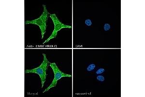 ABIN185280 Immunofluorescence analysis of paraformaldehyde fixed HeLa cells, permeabilized with 0. (ANTXR1 抗体  (C-Term))