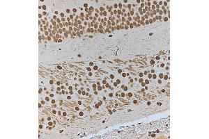 ABIN6256259 and ABIN6267581 at 1/100 staining Mouse brain tissue by IHC-P. (HSF1 抗体  (pSer303))