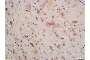 Immunohistochemistry (Paraffin-embedded Sections) (IHC (p)) image for anti-Protein Kinase, AMP-Activated, alpha 1 Catalytic Subunit (PRKAA1) (AA 351-450) antibody (ABIN2170161)