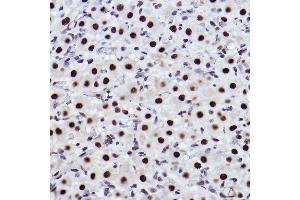Immunohistochemistry of paraffin-embedded rat ovary using CTBP2 Rabbit mAb (ABIN7265979) at dilution of 1:100 (40x lens).
